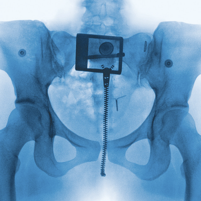 Album cover art for Virgin by Lorde